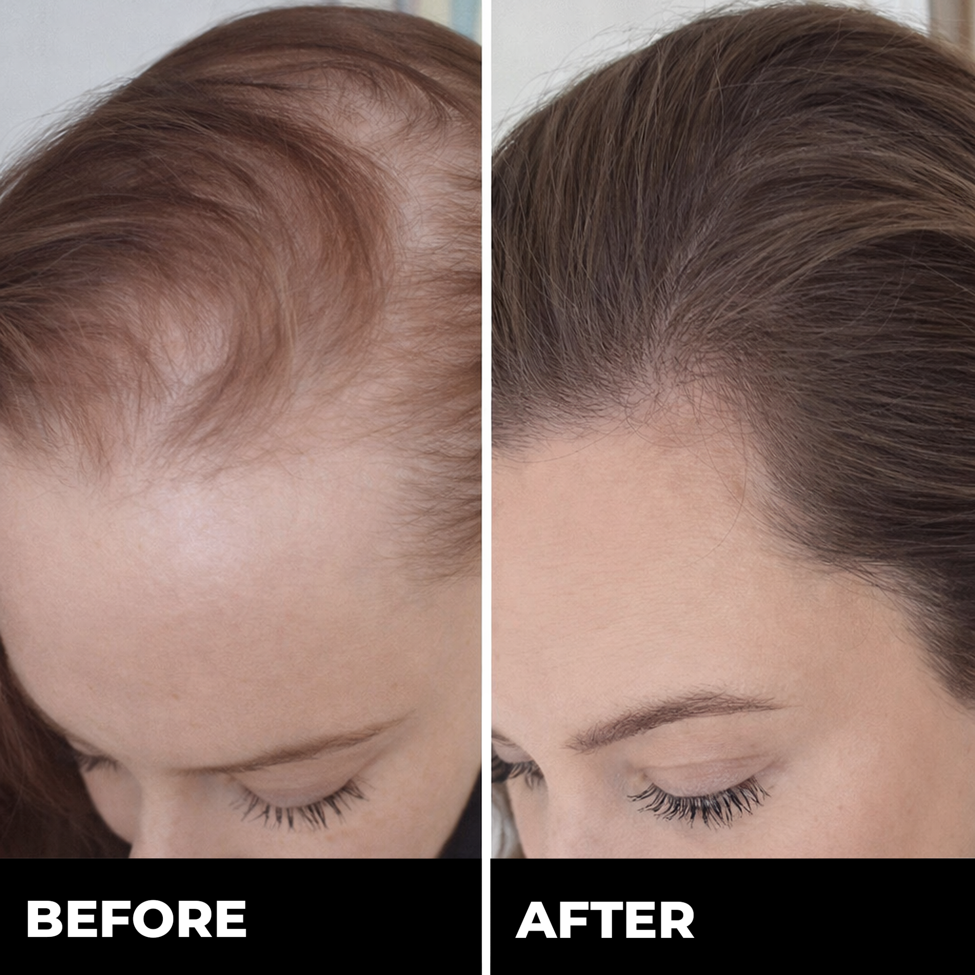 Zylo Hair & Brow Growth Bundle