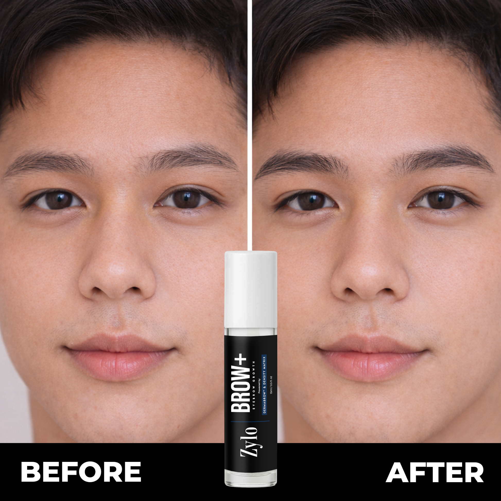 Zylo BROW+
